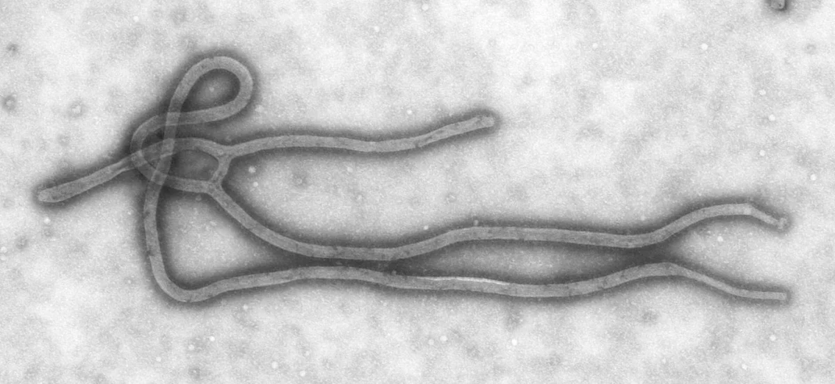 A curled filament of Ebola virus against a pale background.